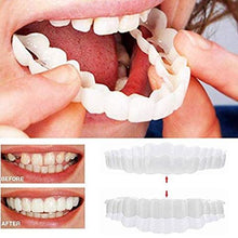 Load image into Gallery viewer, Magic Teeth Snap On Dental Veneers - Upper &amp; Lower Set
