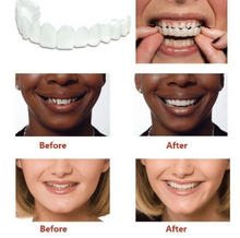 Load image into Gallery viewer, Magic Teeth Snap On Dental Veneers - Upper &amp; Lower Set

