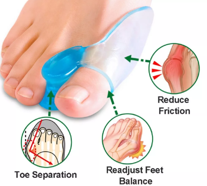 Bunion Corrector & Toe Separator – Orthotic Pain Relief for Foot Alignment