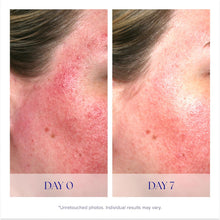 Load image into Gallery viewer, Is CLINICAL Advance+ Pro-Heal Serum 0.5 Oz
