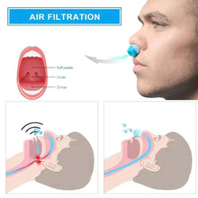 Load image into Gallery viewer, Micro CPAP Device
